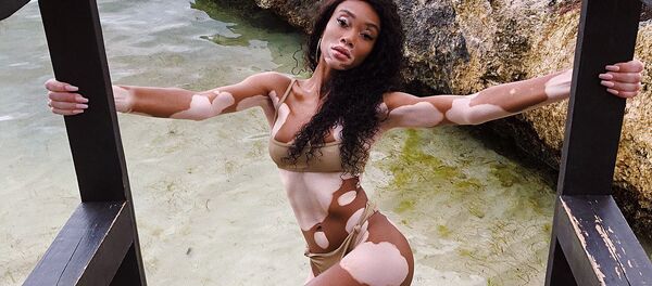 Winnie Harlow Winnie Harlow - Sputnik International