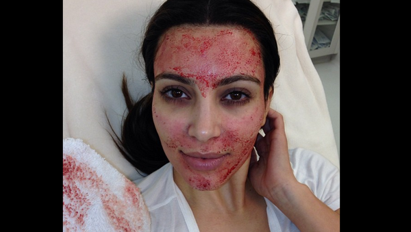 Kim Kardashian, showing off 'vampire facial' in 2013 - Sputnik International
