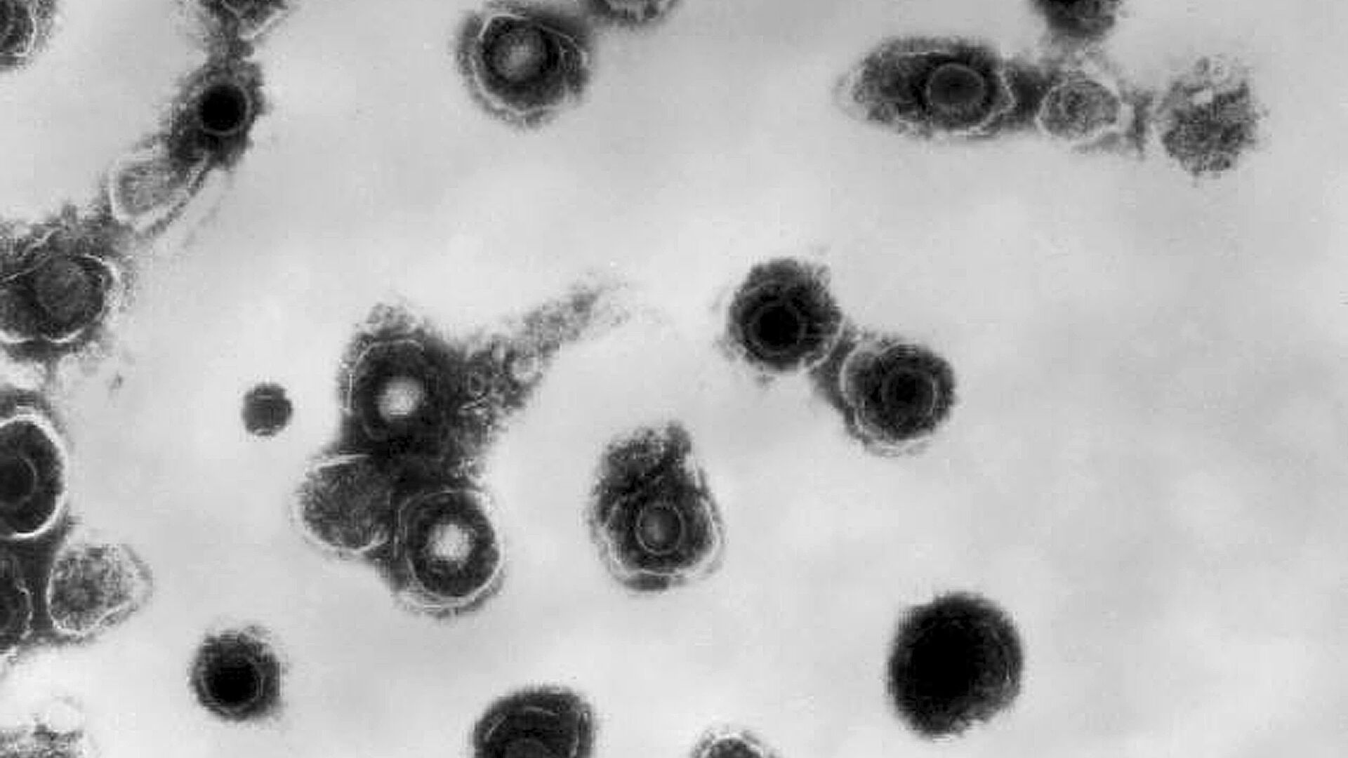 This 1981 electron microscope image made available by the Centers for Disease Control and Prevention shows varicella-zoster virions from a patient with chickenpox. On Thursday, Oct. 11, 2018, the CDC says a small but growing proportion of U.S. toddlers have not been vaccinated against any disease. - Sputnik International, 1920, 22.05.2022