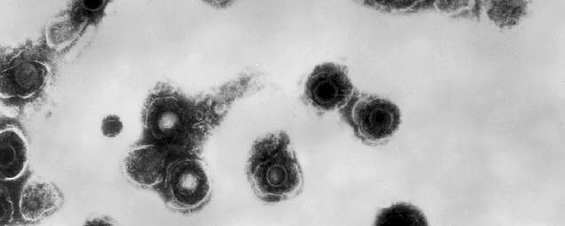 This 1981 electron microscope image made available by the Centers for Disease Control and Prevention shows varicella-zoster virions from a patient with chickenpox. On Thursday, Oct. 11, 2018, the CDC says a small but growing proportion of U.S. toddlers have not been vaccinated against any disease. - Sputnik International, 1920, 22.05.2022