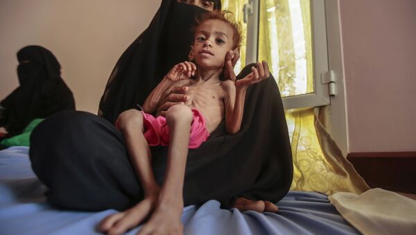 In this Oct. 1, 2018 file photo, a woman holds a malnourished boy at the Aslam Health Center, in Hajjah, Yemen as millions of Yemenis are edging closer to famine and fatal disease one year after a Saudi-led coalition imposed a blockade on sea, land and air routes in the Arab world's poorest country. - Sputnik International