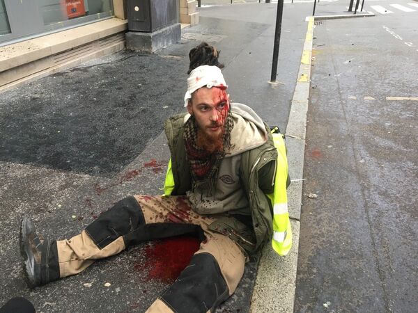 A protester wounded during Yellow Vests protest in Paris on December 8, 2018. A protester wounded during Yellow Vests protest in Paris on December 8, 2018. - Sputnik International