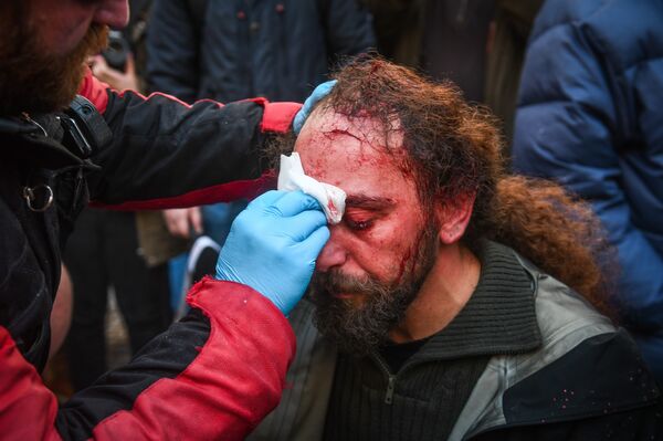Sputnik stringer Kostis Dadamis injured during the protests in Athens Sputnik stringer Kostis Dadamis injured during the protests in Athens - Sputnik International