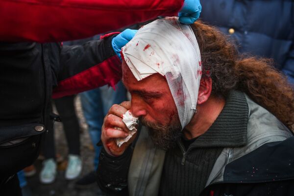 Sputnik stringer Kostis Dadamis injured during the protests in Athens Sputnik stringer Kostis Dadamis injured during the protests in Athens - Sputnik International
