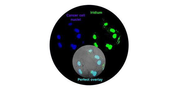 Nucleus‐Targeted Organoiridium–Albumin Conjugate for Photodynamic Cancer Therapy - Sputnik International