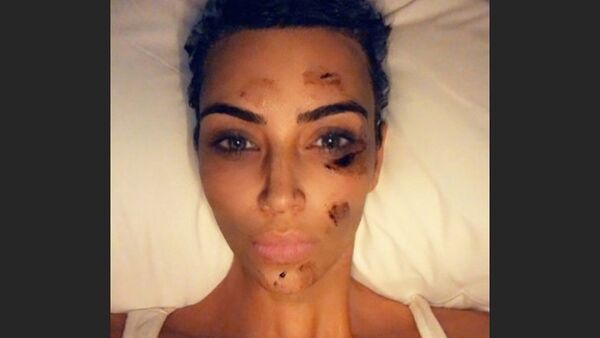 Kim Kardashian shared a photo of a psoriasis flare-up on her face - Sputnik International