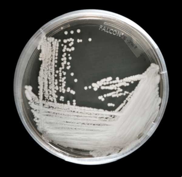 Hong Kong Reports Dramatic Spike in Deadly Superbug Cases Amid COVID-19 Pandemic - Sputnik International