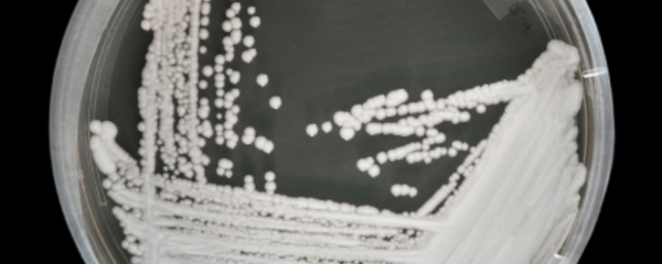 Candida Auris on a petri dish at the CDC Candida Auris on a petri dish at the CDC - Sputnik International