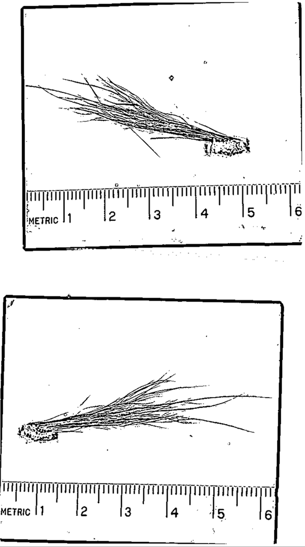 images of hair samples sent to the FBI under suspicion they belonged to Bigfoot images of hair samples sent to the FBI under suspicion they belonged to Bigfoot - Sputnik International