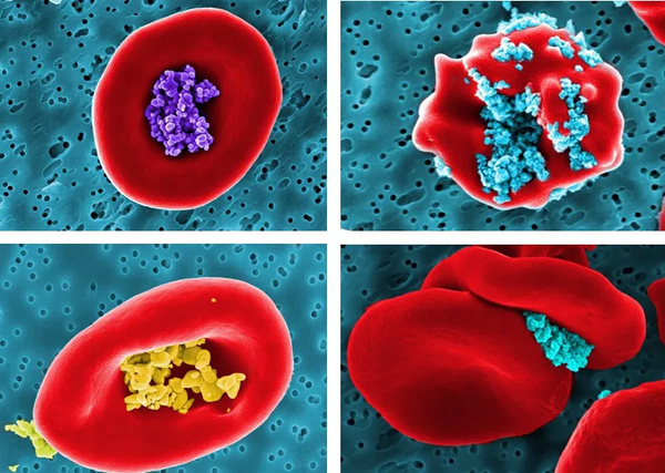 Russian, Finnish Scientists Experiment With Tools to ‘Manoeuvre' Medicine-Carrying Red Blood Cells - Sputnik International