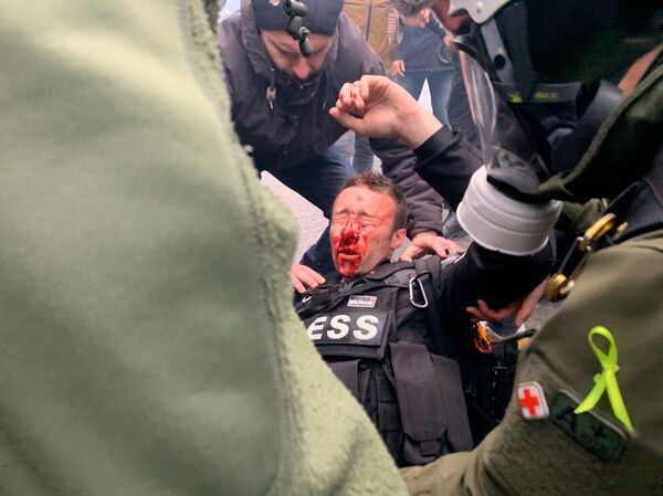 Yellow Vests, One Year On: France’s Most Resilient Contemporary Protest Movement by the Numbers Yellow Vests, One Year On: France’s Most Resilient Contemporary Protest Movement by the Numbers - Sputnik International