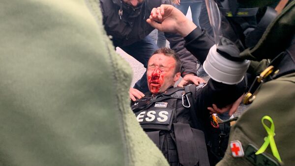 Journalist Seriously Injured During Yellow Vests Protests  - Sputnik International