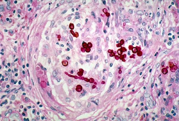 Radiation-Eating Fungus Thriving in Chernobyl Could Shield Cosmonauts From Deadly Solar Rays Radiation-Eating Fungus Thriving in Chernobyl Could Shield Cosmonauts From Deadly Solar Rays - Sputnik International