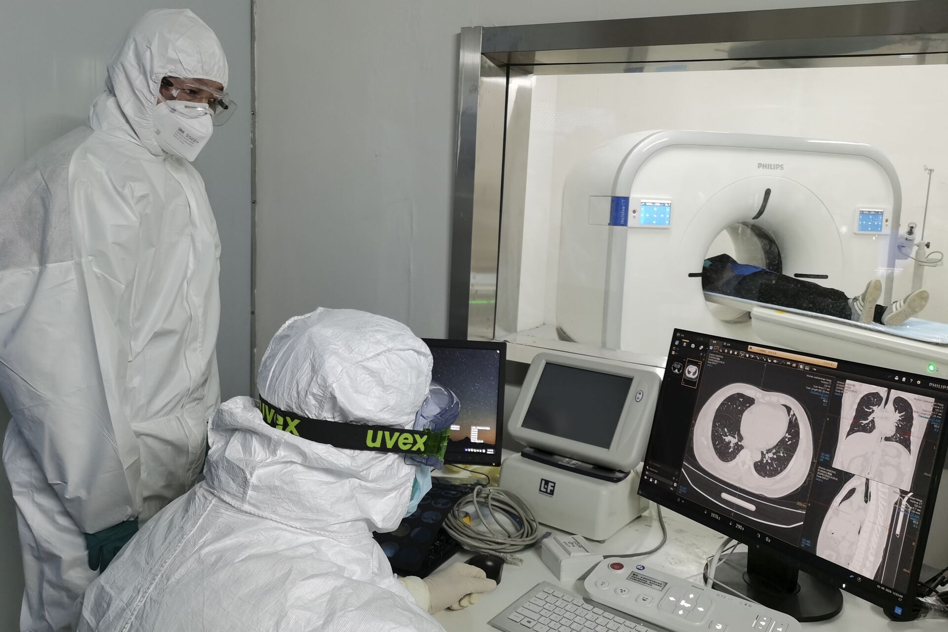 In this Sunday, Feb. 9, 2020, photo released by Xinhua News Agency, doctors scan a patient's lungs at Huoshenshan temporary hospital built for patients diagnosed with coronavirus in Wuhan in central China's Hubei province. Mainland China has reported another rise in cases of the new virus after a sharp decline the previous day, while the number of deaths grow over 900, with at least two more outside the country. (Gao Xiang/Xinhua via AP) - Sputnik International, 1920, 07.09.2021