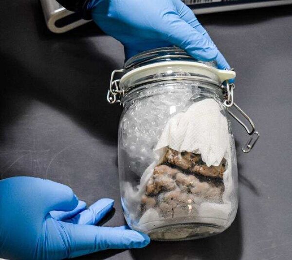 Photo: US Border Patrol Discovers Human Brain Tucked Into Package From Canada Photo: US Border Patrol Discovers Human Brain Tucked Into Package From Canada - Sputnik International