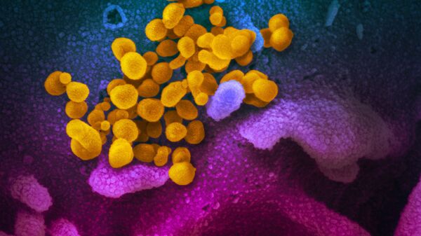This scanning electron microscope image shows SARS-CoV-2 (yellow)—also known as 2019-nCoV, the virus that causes COVID-19—isolated from a patient in the U.S., emerging from the surface of cells (blue/pink) cultured in the lab.  - Sputnik International