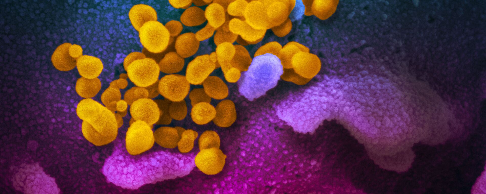 This scanning electron microscope image shows SARS-CoV-2 (yellow)—also known as 2019-nCoV, the virus that causes COVID-19—isolated from a patient in the U.S., emerging from the surface of cells (blue/pink) cultured in the lab.  - Sputnik International, 1920, 22.06.2021