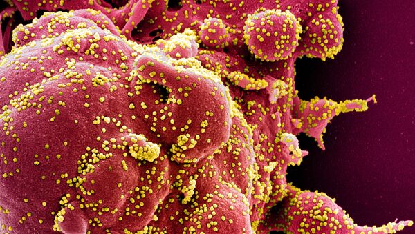 Colorized scanning electron micrograph of an apoptotic cell (red) infected with SARS-COV-2 virus particles (yellow), also known as novel coronavirus, isolated from a patient sample. Image captured at the NIAID Integrated Research Facility (IRF) in Fort Detrick, Maryland - Sputnik International