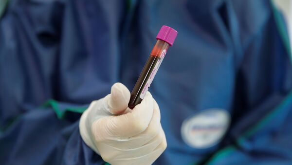 A medical specialist holds a testing tube with blood in Hadassah clinic, which offers tests for for antibodies against the coronavirus disease (COVID-19), at the Skolkovo innovation centre on the outskirts of Moscow, Russia April 24, 2020 - Sputnik International