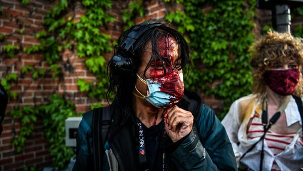 A journalist is seen bleeding after police started firing tear gas and rubber bullets near the 5th police precinct following a demonstration to call for justice for George Floyd, a black man who died while in custody of the Minneapolis police, on May 30, 2020 in Minneapolis, Minnesota - Sputnik International