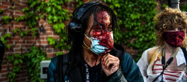 A journalist is seen bleeding after police started firing tear gas and rubber bullets near the 5th police precinct following a demonstration to call for justice for George Floyd, a black man who died while in custody of the Minneapolis police, on May 30, 2020 in Minneapolis, Minnesota A journalist is seen bleeding after police started firing tear gas and rubber bullets near the 5th police precinct following a demonstration to call for justice for George Floyd, a black man who died while in custody of the Minneapolis police, on May 30, 2020 in Minneapolis, Minnesota - Sputnik International