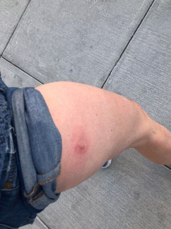 Sputnik Journalist Wounded by US Police While Covering Protests in Washington, DC - Sputnik International