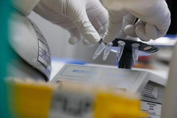 Russian Defence Ministry Says COVID Vaccine Trials on Another Group of 20 Volunteers Over Russian Defence Ministry Says COVID Vaccine Trials on Another Group of 20 Volunteers Over - Sputnik International