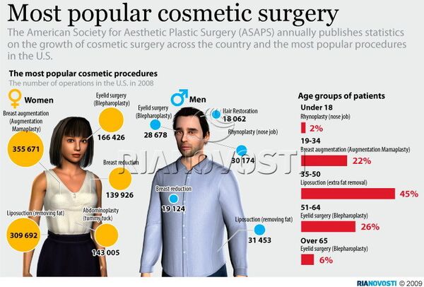 Most popular cosmetic surgery - Sputnik International