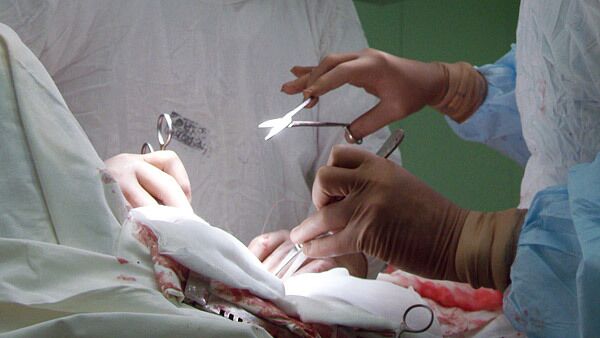 Over 20 needles discovered in Brazilian woman's body - Sputnik International