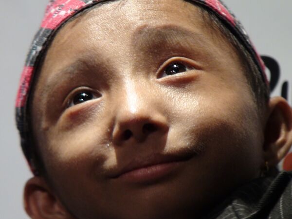 Nepalese teen to become world’s tiniest man in one month  - Sputnik International
