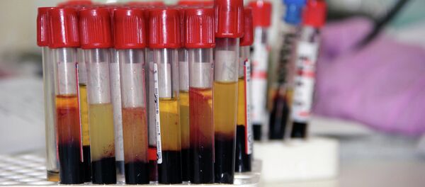 Ampoules with blood tests Ampoules with blood tests - Sputnik International