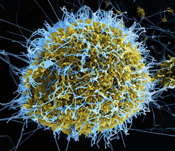 Ebola Virus particles - Sputnik International